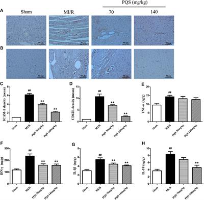 Panax quinquefolius L. Saponins Protect Myocardial Ischemia Reperfusion No-Reflow Through Inhibiting the Activation of NLRP3 Inflammasome via TLR4/MyD88/NF-κB Signaling Pathway